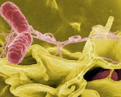 Statement on Salmonella cases in KwaZulu-Natal Province