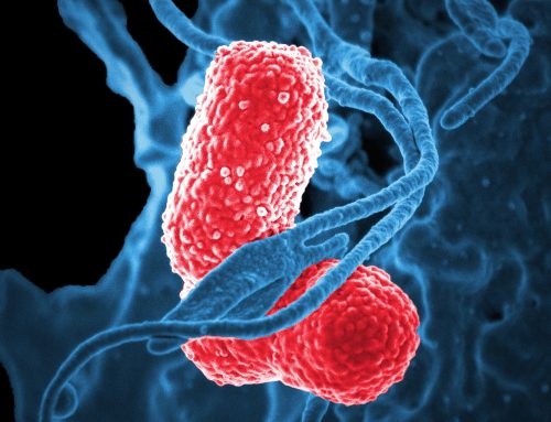 OUTBREAK OF CARBAPENEM–RESISTANT KLEBSIELLA INFECTIONS AT TEMBISA HOSPITAL